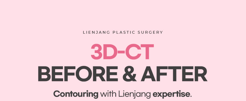 Facial contouring at Lienjang: Correcting square jaw to a perfect V-line, enhancing facial balance and definition with tailored, expert surgery.