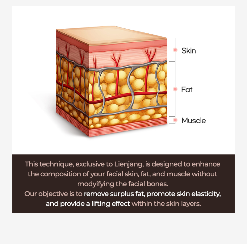 Facial liposuction at Lienjang for a perfect V-line, shaping the chin and jawline to enhance facial proportions and create a youthful look